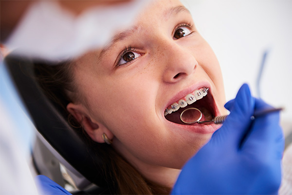 ortodontia-aparelho-odontologico